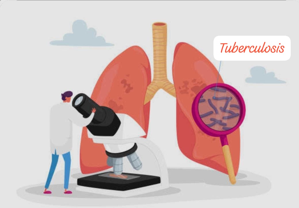 Jenis Pemeriksaan Laboratorium untuk Pasien TBC (Tuberculosis)